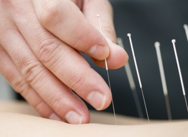 Yin Yang - Clinica Acupunctura si medicina integrativa